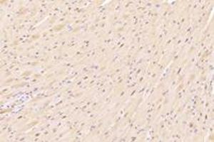 Immunohistochemistry analysis of paraffin-embedded mouse heart using,ZFP90 (ABIN7076275) at dilution of 1: 4200 (ZNF90 Antikörper)