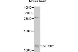 Western blot analysis of extracts of mouse heart, using SLURP1 antibody (ABIN5975091) at 1/1000 dilution. (SLURP1 Antikörper)