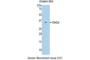 Western Blotting (WB) image for anti-Gap Junction Protein, beta 3, 31kDa (GJB3) (AA 213-270) antibody (ABIN1174652)