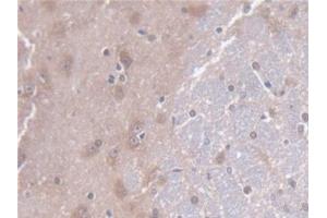 Immunohistochemistry (IHC) image for anti-CD7 (CD7) (AA 23-128) antibody (ABIN7444427)