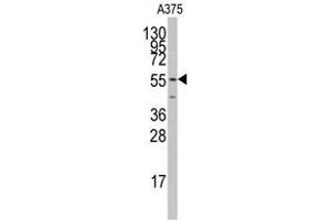 Western blot analysis of anti-PTRF Antibody (N-term) Pab (ABIN391622 and ABIN2841541) in  cell line lysates (35 μg/lane).