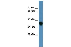 WB Suggested Anti-AKR1C1 Antibody Titration: 0. (AKR1C1 Antikörper  (N-Term))