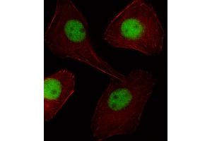 Fluorescent image of U251 cell stained with PGR/PR Antibody . (PGLYRP1 Antikörper  (C-Term))