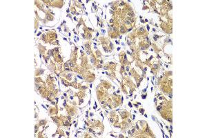 Immunohistochemistry of paraffin-embedded human gastric using DGKE antibody at dilution of 1:100 (40x lens).