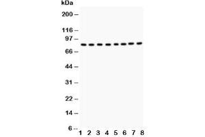 Western blot testing of BRAF antibody and Lane 1:  rat testis tissue;  2: rat brain tissue;  3: mouse testis tissue;  4: mouse brain tissue;  and human samples 5: HeLa;  6: Jurkat;  7: MCF-7;  8: K562 (BRAF Antikörper  (AA 38-230))
