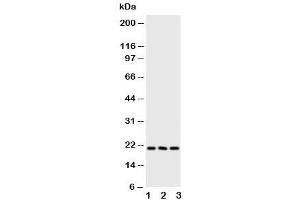 Western Blotting (WB) image for anti-Fibroblast Growth Factor 21 (FGF21) (AA 43-58) antibody (ABIN3030935)