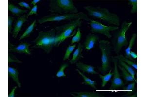 Immunofluorescence of purified MaxPab antibody to ANKMY1 on HeLa cell. (ANKMY1 Antikörper  (AA 1-720))