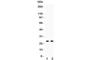 Western blot testing of PSCA antibody and Lane 1:  rat stomach;  2: mouse stomach;  Predicted size: 13KD;  Observed glycosylated size: up to 29KD (PSCA Antikörper  (AA 21-95))