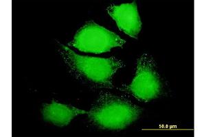 Immunofluorescence of purified MaxPab antibody to IL6 on HeLa cell.