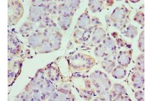 Immunohistochemistry of paraffin-embedded human pancreatic tissue using ABIN7156650 at dilution of 1:100 (IFIH1 Antikörper  (AA 1-205))