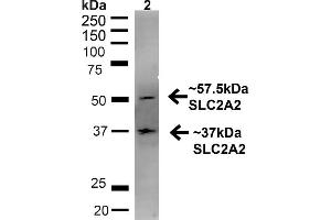 Western blot analysis of Rat Liver showing detection of ~57. (SLC2A2 Antikörper  (C-Term) (PE))