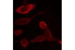 ABIN6266956 staining HeLa cells by IF/ICC. (CYP2U1 Antikörper  (Internal Region))