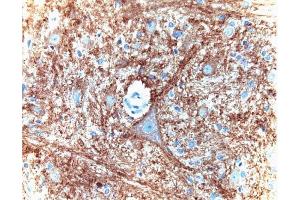 Immunohistochemical staining for Munc-18 on a formalin-fixed, paraffin-embedded rat brain section with citrate buffer pretreatment (40X magnification). (STXBP1 Antikörper  (AA 18-1))