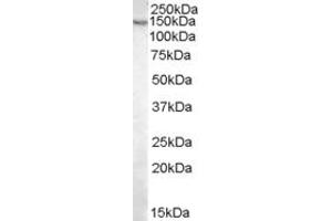 Image no. 1 for anti-Pyruvate Carboxylase (PC) (Internal Region) antibody (ABIN374944) (PC Antikörper  (Internal Region))