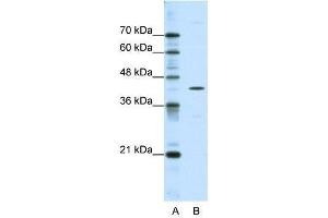Western Blot showing DOK2 antibody used at a concentration of 1-2 ug/ml to detect its target protein. (DOK2 Antikörper  (C-Term))