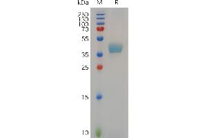 SDS-PAGE (SDS) image for Chemokine (C-C Motif) Receptor 8 (CCR8) (AA 1-35) protein (Fc Tag) (ABIN7490743)