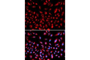 Immunofluorescence analysis of U2OS cells using CLDN11 antibody (ABIN5971415). (Claudin 11 Antikörper)