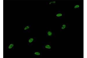 Immunofluorescence of monoclonal antibody to SNRPA on HeLa cell. (SNRPA1 Antikörper  (AA 1-282))