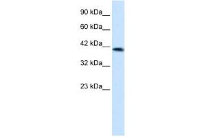 WB Suggested Anti-ZNF670 Antibody Titration:  1.