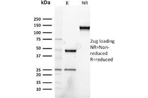 SDS-PAGE Analysis Purified Heregulin-1 Mouse Monoclonal Antibody (NRG1/2752). (Neuregulin 1 Antikörper  (AA 21-242))