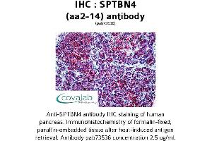Image no. 3 for anti-Spectrin Beta, Non-Erythrocytic 4 (SPTBN4) (AA 2-14) antibody (ABIN1739626) (SPTBN4 Antikörper  (AA 2-14))