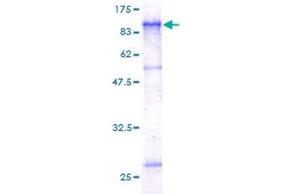 SCNN1B Protein (AA 1-640) (GST tag)