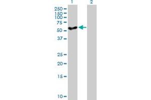 Western Blotting (WB) image for anti-Cytochrome P450, Family 27, Subfamily A, Polypeptide 1 (CYP27A1) (AA 1-531) antibody (ABIN514855)