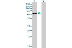 Western Blot analysis of CYP27A1 expression in transfected 293T cell line by CYP27A1 MaxPab polyclonal antibody.