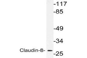 Western blot (WB) analysis of Claudin-8 antibody in extracts from Jurkat cells. (CLDN8 Antikörper)