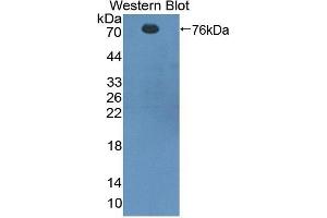 Detection of Recombinant CTTN, Rat using Polyclonal Antibody to Cortactin (CTTN) (Cortactin Antikörper  (AA 1-509))