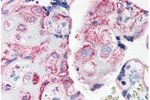 Human Placenta (formalin-fixed, paraffin-embedded) stained with C5AR1 antibody ABIN461687 followed by biotinylated goat anti-rabbit IgG secondary antibody ABIN481713, alkaline phosphatase-streptavidin and chromogen. (C5AR1 Antikörper  (Internal Region))