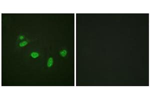 Immunofluorescence analysis of HeLa cells, using ETS1 (Phospho-Thr38) antibody. (ETS1 Antikörper  (pThr38))