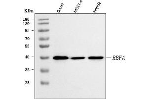 Western blot analysis of C18orf22/RBFA using anti-C18orf22/RBFA antibody (ABIN7600106). (RBFA Antikörper  (AA 15-319))