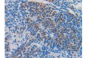 Immunohistochemistry (IHC) image for anti-Fibulin 4 (FBLN4) (AA 182-431) antibody (ABIN7437848)