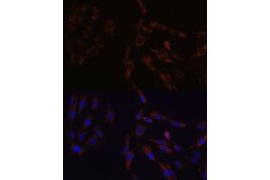 Immunofluorescence analysis of C6 cells using SUCLG2 Polyclonal Antibody  at dilution of 1:100 (40x lens). (SUCLG2 Antikörper  (AA 50-300))