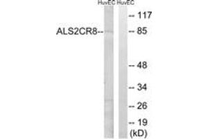 Western blot analysis of extracts from HuvEc cells, using ALS2CR8 Antibody. (Calcium Responsive Transcription Factor (CARF) (AA 311-360) Antikörper)
