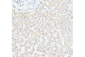 IHC analysis of CYP27A1 using anti-CYP27A1 antibody (ABIN7602336).