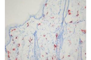 Immunohistochemistry (IHC) image for anti-Macrophages antibody (ABIN781726) (Macrophages Antikörper)