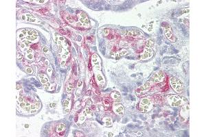 Anti-LGALS1 / Galectin 1 antibody IHC of human placenta. (LGALS1/Galectin 1 Antikörper  (AA 72-121))