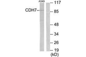Western blot analysis of extracts from A549 cells, using CDH7 Antibody. (Cadherin 7 Antikörper  (AA 651-700))