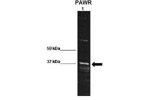 WB Suggested Anti-PAWR Antibody    Positive Control:  Lane 1: 30ug rat striatum homogenate  Primary Antibody Dilution :   1:1000  Secondary Antibody :  Anti rabbit-HRP   Secondry Antibody Dilution :   1:10,000  Submitted by:  Kristy Shimp, University of Florida