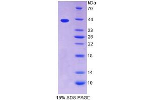 SDS-PAGE (SDS) image for Tropomyosin-2 (TPM2) (AA 1-284) protein (His tag) (ABIN6238635)