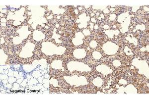 Immunohistochemistry (IHC) image for anti-Neighbor of BRCA1 Gene 1 (NBR1) antibody (ABIN5957970) (NBR1 Antikörper)