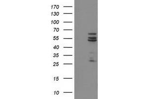 Western Blotting (WB) image for anti-Cytochrome P450, Family 2, Subfamily C, Polypeptide 9 (CYP2C9) antibody (ABIN1497725)