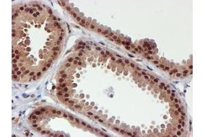 Immunohistochemical staining of paraffin-embedded Human breast tissue using anti-CYP17A1 mouse monoclonal antibody. (CYP17A1 Antikörper)