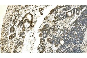 IHC analysis of Carbonic Anhydrase 13/CA13 using anti-Carbonic Anhydrase 13/CA13 antibody (ABIN7603164). (CA13 Antikörper  (N-Term))