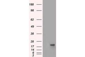 Image no. 2 for anti-Crystallin, alpha B (CRYAB) antibody (ABIN1497646) (CRYAB Antikörper)