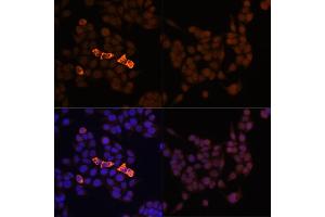 Immunofluorescence analysis of HeLa-Myc-CandHeLa cells using Rabbit anti Myc-Tag pAb-C-terminal (ABIN3020568 and ABIN3020569) at dilution of 1:100 (40x lens). (Myc Tag Antikörper)