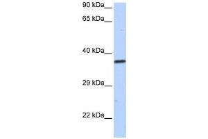 Western Blotting (WB) image for anti-Sex Comb On Midleg-Like 1 (SCML1) antibody (ABIN2458174) (SCML1 Antikörper)