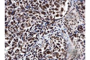 Immunohistochemistry (IHC) image for anti-X-Ray Repair Complementing Defective Repair in Chinese Hamster Cells 6 (XRCC6) (C-Term) antibody (ABIN2855186)